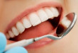 Điểm khác biệt của Răng toàn sứ so với các dòng răng sứ khác