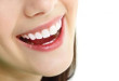 Làm gì để răng trắng hơn? << Giải pháp làm trắng răng hiệu quả nhất