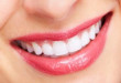 Chia sẻ từ A-Z các vấn đề về kem tẩy trắng răng mà bạn cần biết