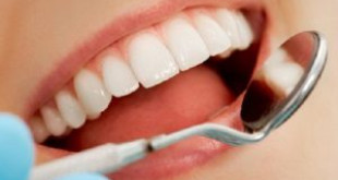 Điểm khác biệt của Răng toàn sứ so với các dòng răng sứ khác