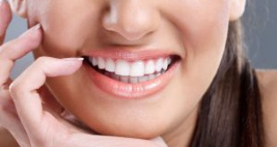 Bọc mão răng sứ – Giải pháp toàn diện cho hàm răng trắng sáng như SAO