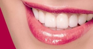 Áp dụng cách làm sạch răng sau, răng trắng không kém gì tẩy răng