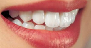 Trồng răng implant hết bao nhiêu tiền??>>> CLICK HERE.