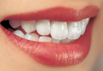 Điểm danh các phương pháp làm răng thẩm mỹ hot nhất hiện nay