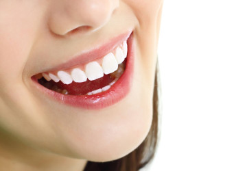 Làm gì để răng trắng hơn? << Giải pháp làm trắng răng hiệu quả nhất