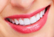Răng sứ có tuổi thọ bao lâu? – Kiến thức làm răng sứ thẩm mỹ