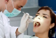 Khi nào nên hàn răng? >>> Top những trường hợp cần hàn răng ngay