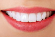 Làm răng phủ sứ – Coi chừng rước họa vào thân từ lời quảng cáo hoa mỹ