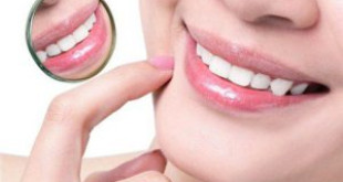 Răng sứ có bền không ?- Yếu tố nào ảnh hưởng đến tuổi thọ của răng sứ?
