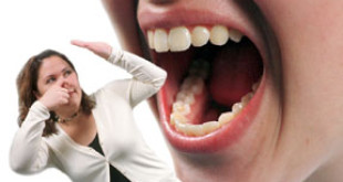 Top 4 cách chữa bệnh hôi miệng hiệu quả nhất