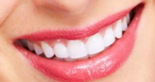 Chia sẻ từ A-Z các vấn đề về kem tẩy trắng răng mà bạn cần biết
