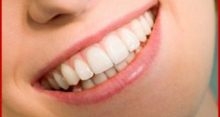 Làm răng sứ thẩm mỹ mang lại lợi ích gì?