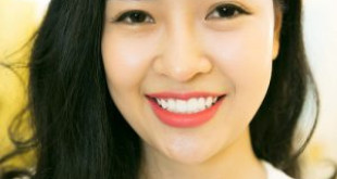 Làm răng sứ cao cấp – Giải pháp để có nụ cười hoàn mỹ
